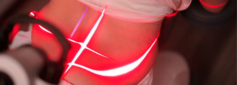 Can Lasers Help Balance My Hormones?