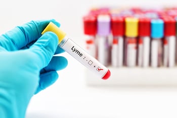 What You Think You Know About Lyme—Why Conventional Doctors Miss Lyme Disease (And How to Catch It)