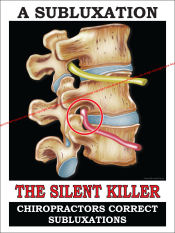 Subluxations - Silent Killer Pic